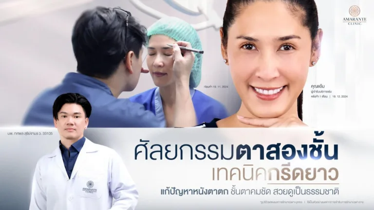 ทำตาสองชั้นกรีดยาว คืออะไร?