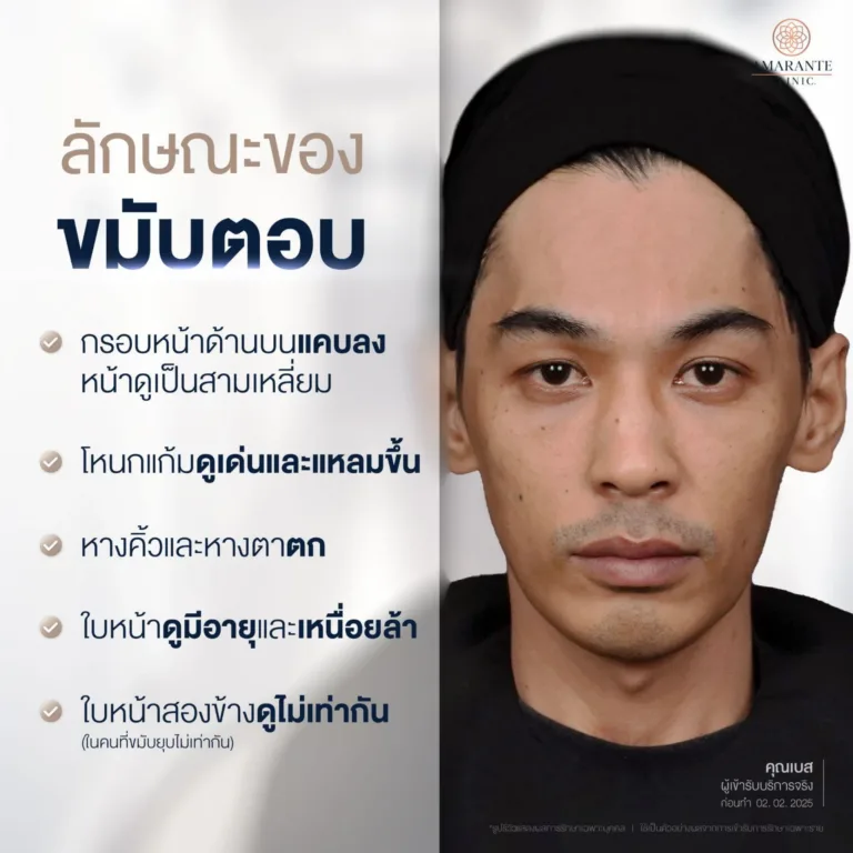 ลักษณะของขมับตอบ