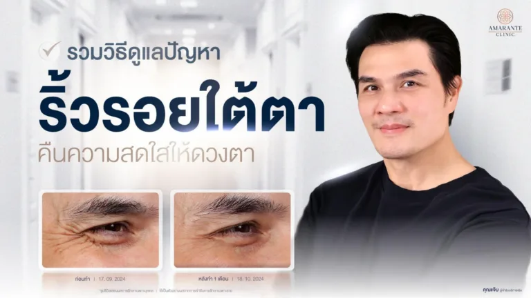 วิธีดูแลปัญหาริ้วรอยใต้ตา