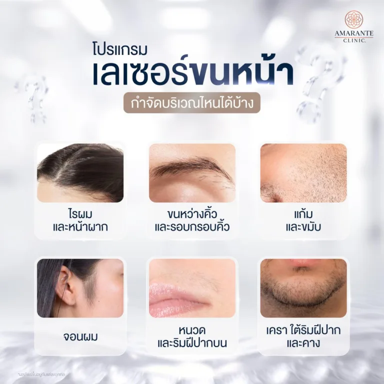 ลเซอร์ขนหน้า กำจัดขนบริเวณไหนได้บ้าง