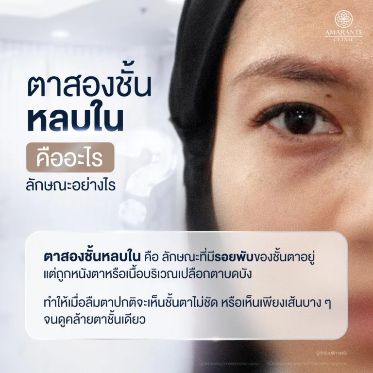 ลักษณะ ตาสองชั้นหลบใน