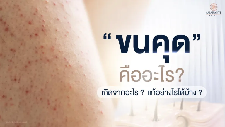 ขนคุด คืออะไร? ขนคุดอักเสบ เกิดจากอะไร แก้อย่างไรได้บ้าง