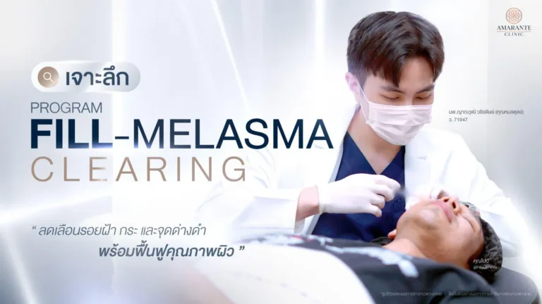 เจาะลึก "ฉีดฝ้า" ลดเลือนรอยฝ้า กระ และจุดด่างดำ