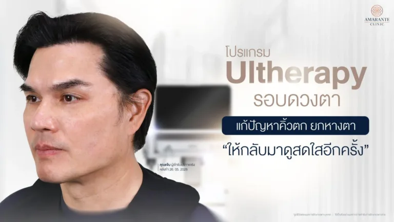 Ulthera รอบดวงตา แก้คิ้วตก ยกหางตา